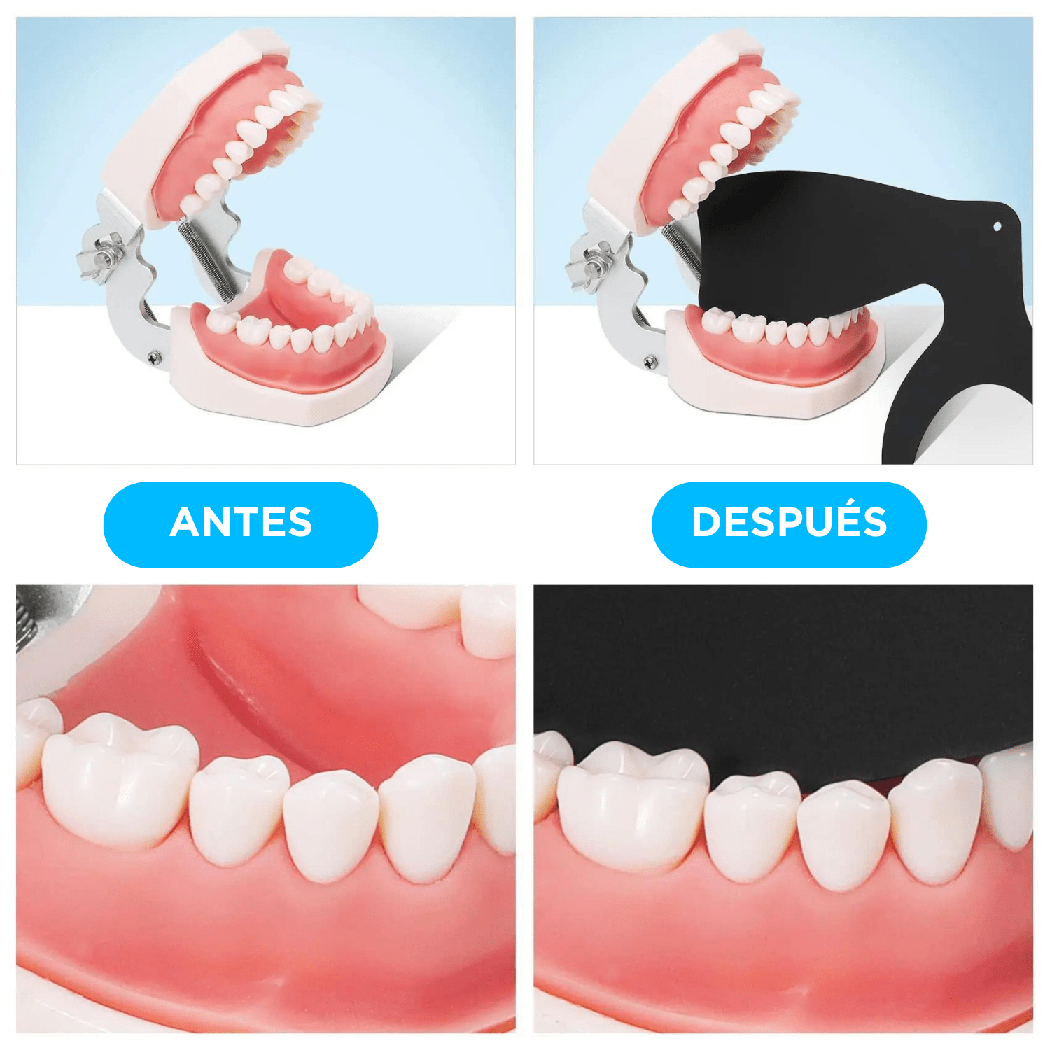 Kit de placas de contraste para fotografía intraoral (6pzas)